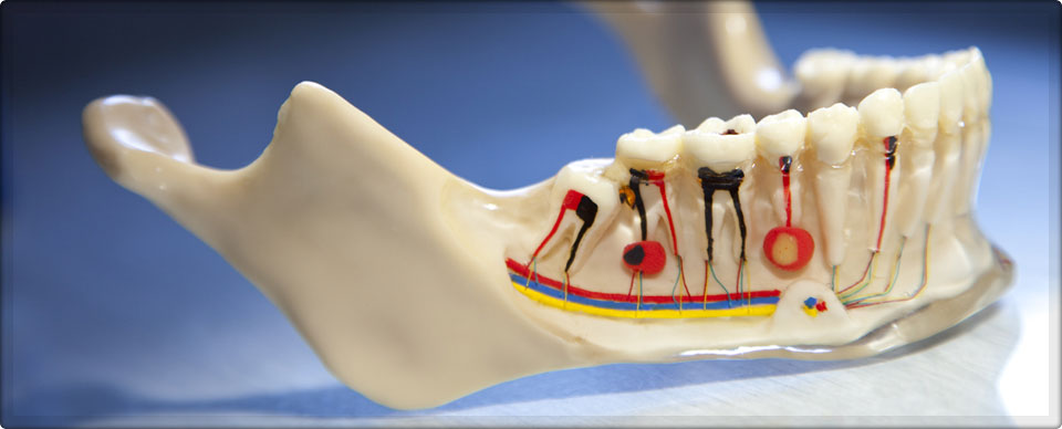 Root Canal Treatment India